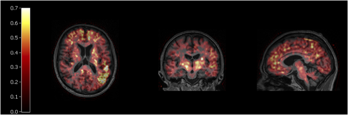 3-sided profile image of human head